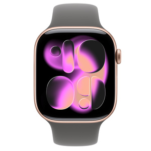 Amazon Apple Watch Series Rose Gold With Black Band Gps Cellular